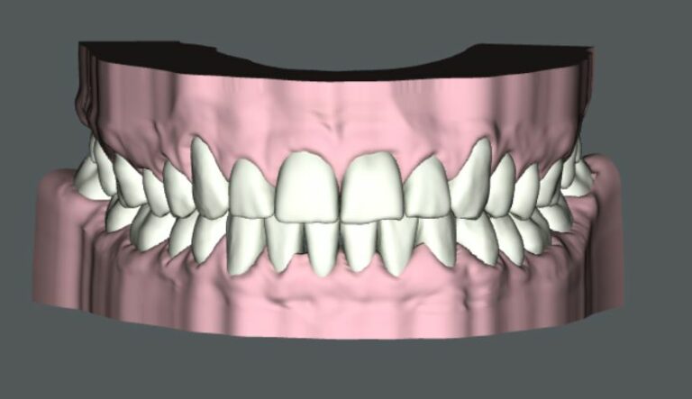 Digitales 3D-Modell eines Gebisses mit geraden Zähnen